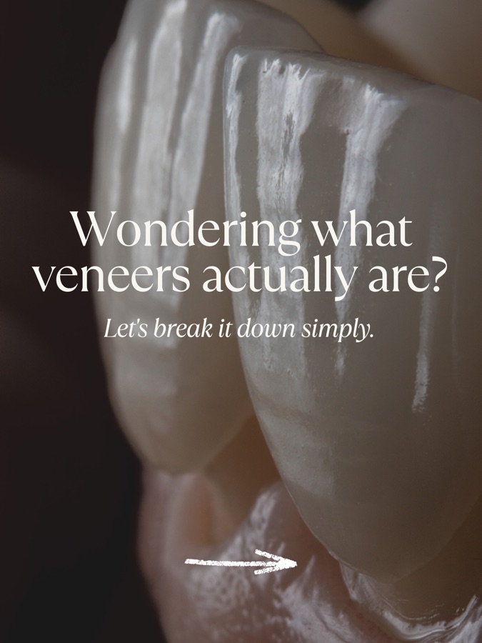 Wondering what veneers actually are? A simple visual guide by FB Dental Yarrabilba