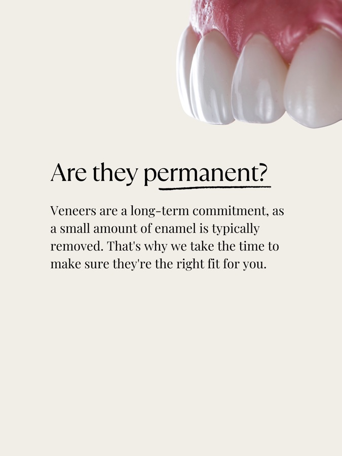Are veneers permanent? Veneers are a long-term commitment because a small amount of enamel is typically removed